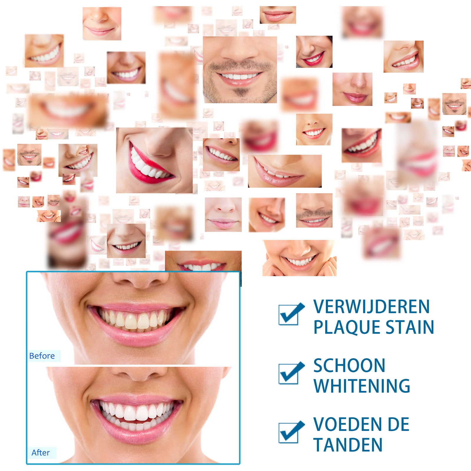 Teeth White Pen for Brightening Oral Care Remove Stains and Yellowing - Smile Brighter with the Magic teeth white pen