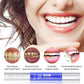 Teeth whitening pen - Smile Bright with Our Teeth Whitening Pen Magic