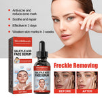 Tender Skin Care Facial Essence with PCA Sodium and Glycerol 30ml - Teleplus tender skin care facial essence pca sodium