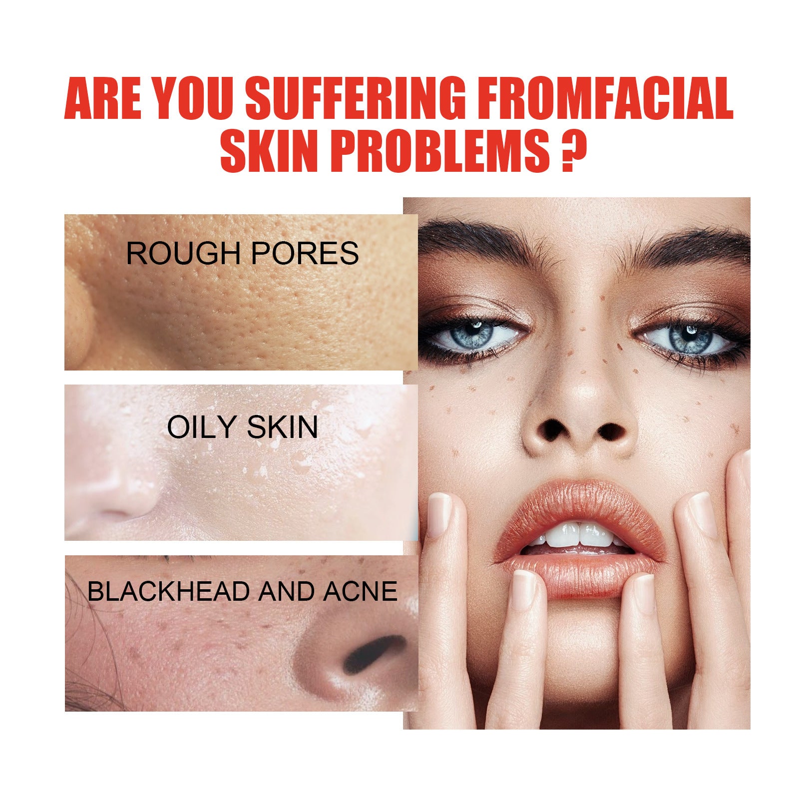 Tender Skin Care Facial Essence with PCA Sodium and Glycerol 30ml - Teleplus tender skin care facial essence pca sodium