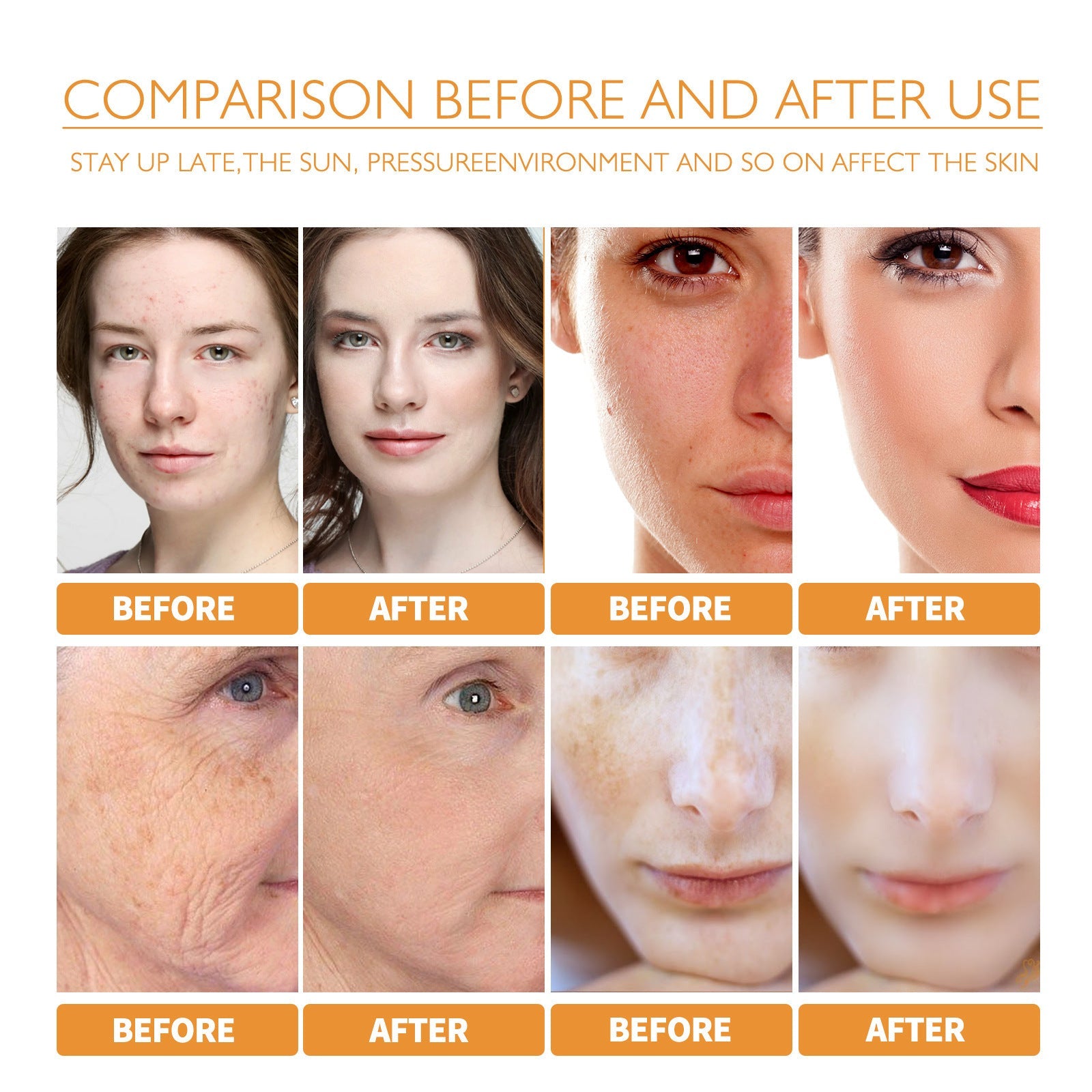 Turmeric Facial Smallpox Serum for Diluting and Refreshing Skin - Teleplus turmeric facial smallpox diluting refreshing