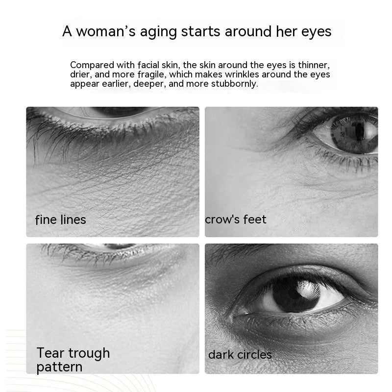 Ultrasonic Eye Beautification Instrument with Radio Frequency EMS Blue - for the Lazy Glamour Queen ultrasonic eye