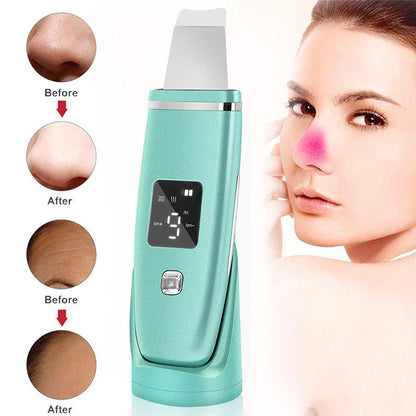 Ultrasonic Vibration Blackhead Remover Deep Cleansing Face Scrubber Pore Cleaner Lifting Machine Facial Led Peeling