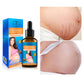 Universal Essential Oil for Abdomen Thigh and Hip Pain Relief - Abdominal