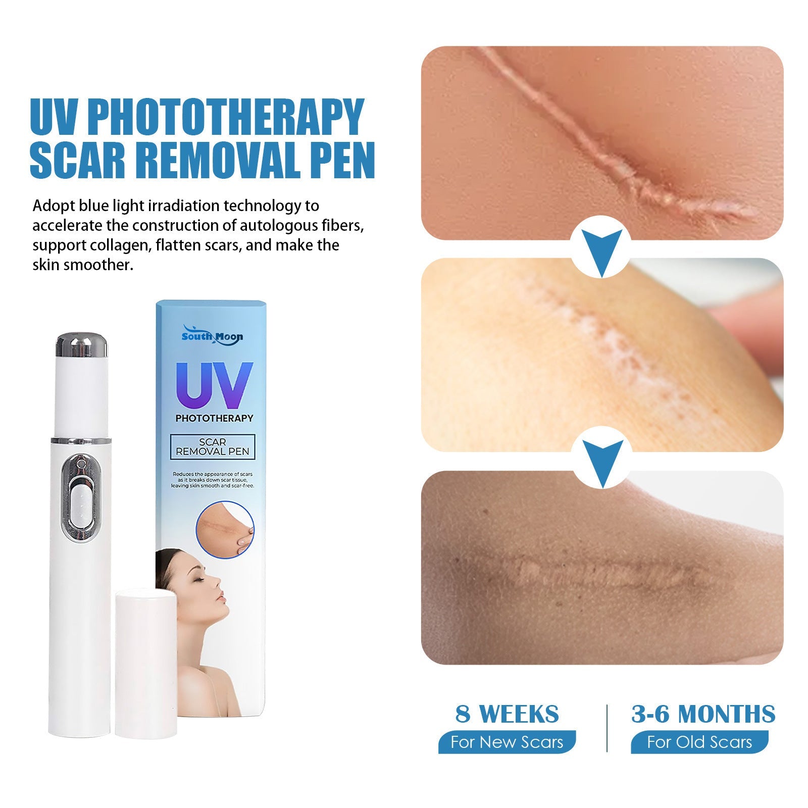 UV Light Scar Pen Gentle Fade Repair Skin Scar Smooth Skin Light Scar Pen - Banishing Scars with the Light Scar Pen