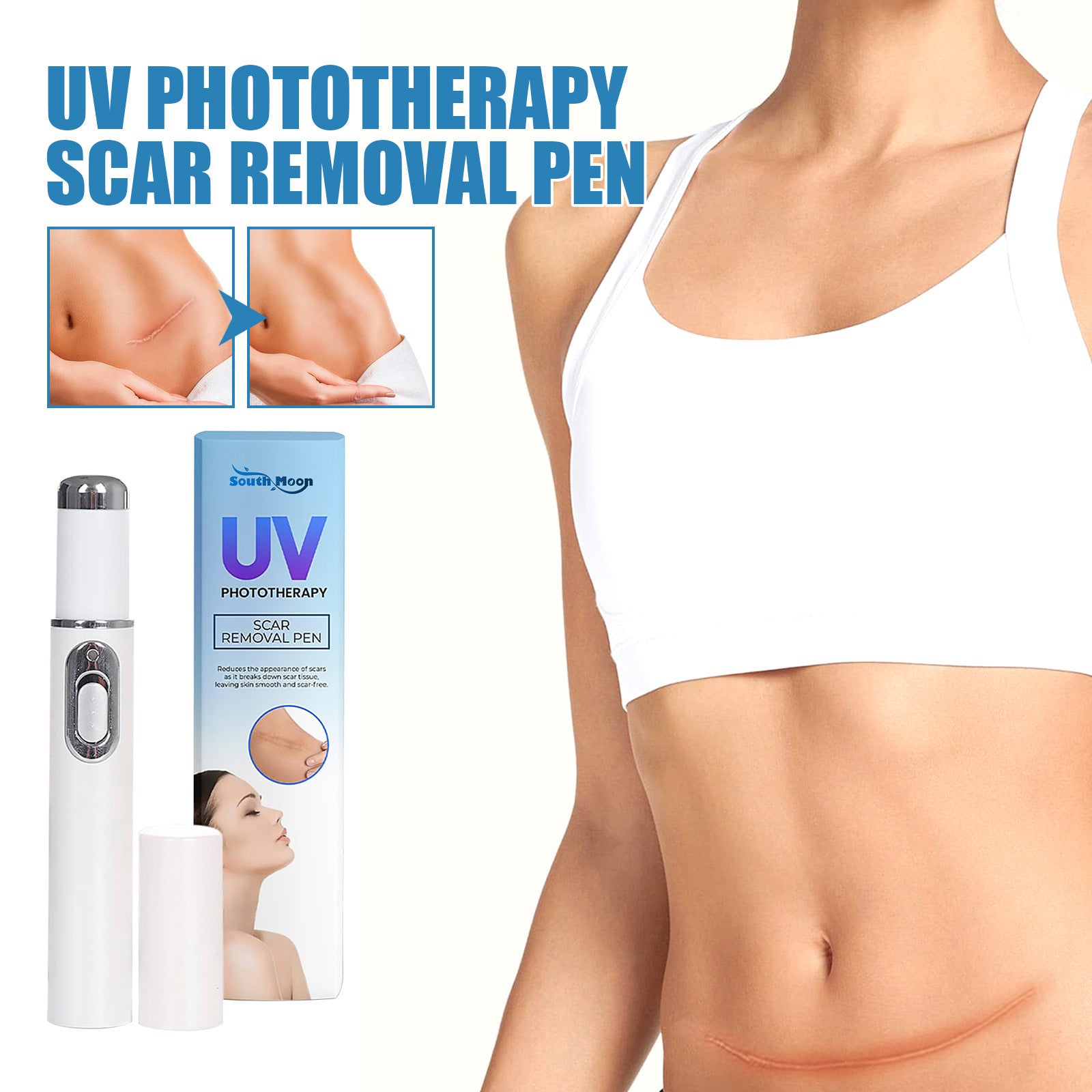 UV Light Scar Pen Gentle Fade Repair Skin Scar Smooth Skin Light Scar Pen - Banishing Scars with the Light Scar Pen