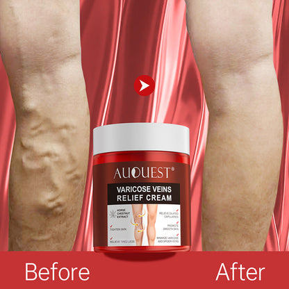 Venous Cream for Legs Blood Vessels Bulge Moisturizing 80g - Leg: Bye venous cream leg blood vessels bulge