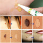 Wart Removal Care Pen for Family Use Apply in the United States - care pen apply wart removal united states