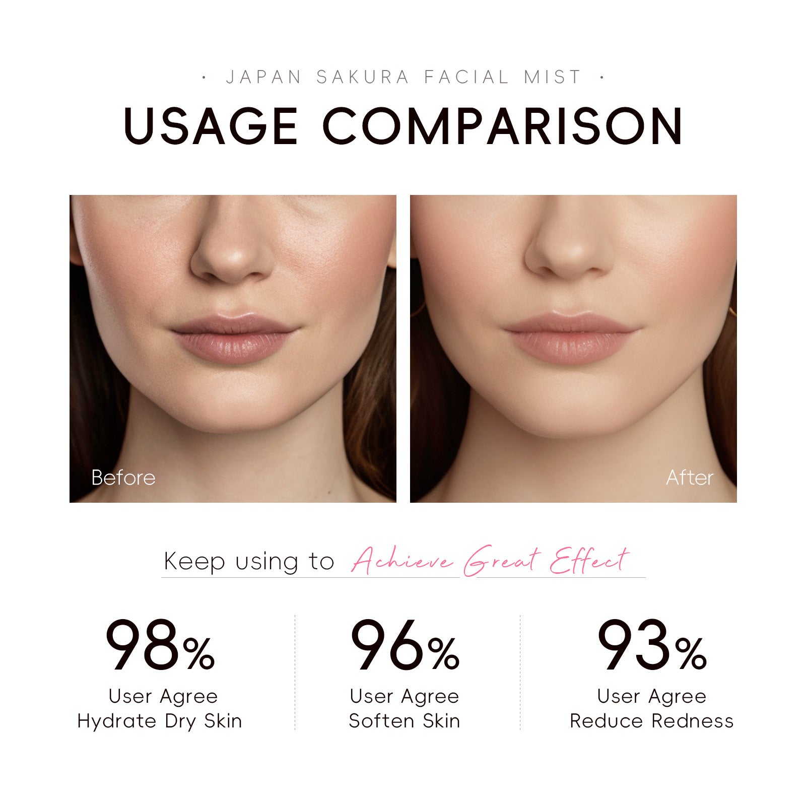 Wet Compress Lotion 100ml Hydrating Moisturizer for Face and Skin Care - Teleplus wet compress lotion