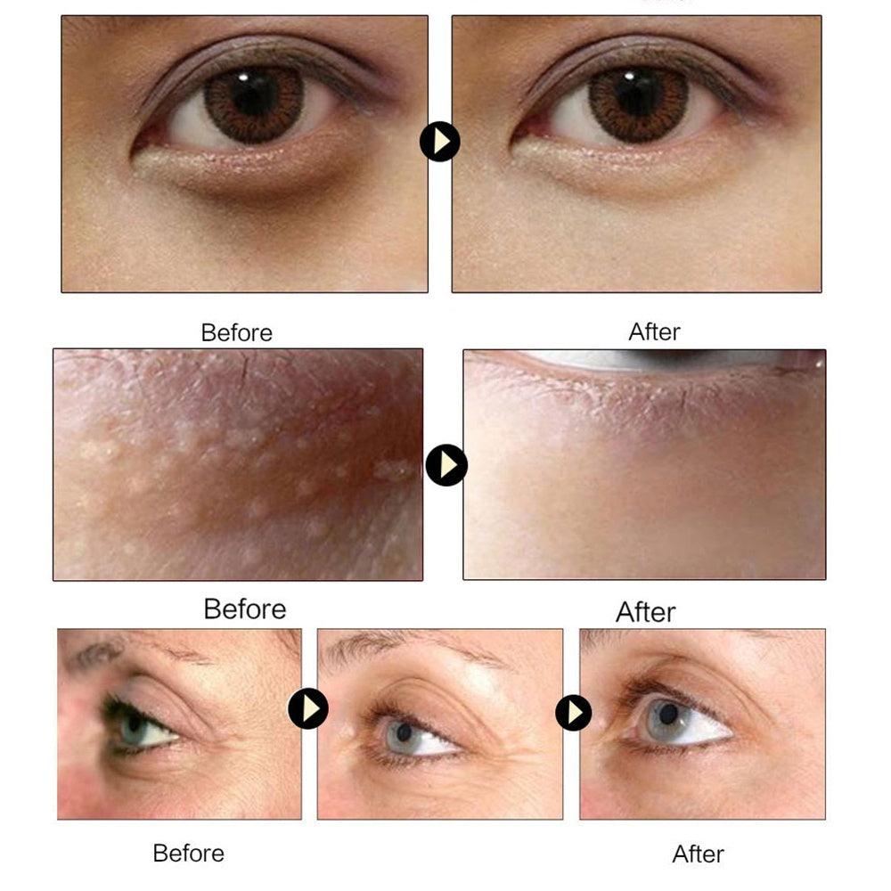 Wireless Rechargeable Hot Compress Eye Mask for Atomization and Cleaning - hot compress eye atomization cleaning