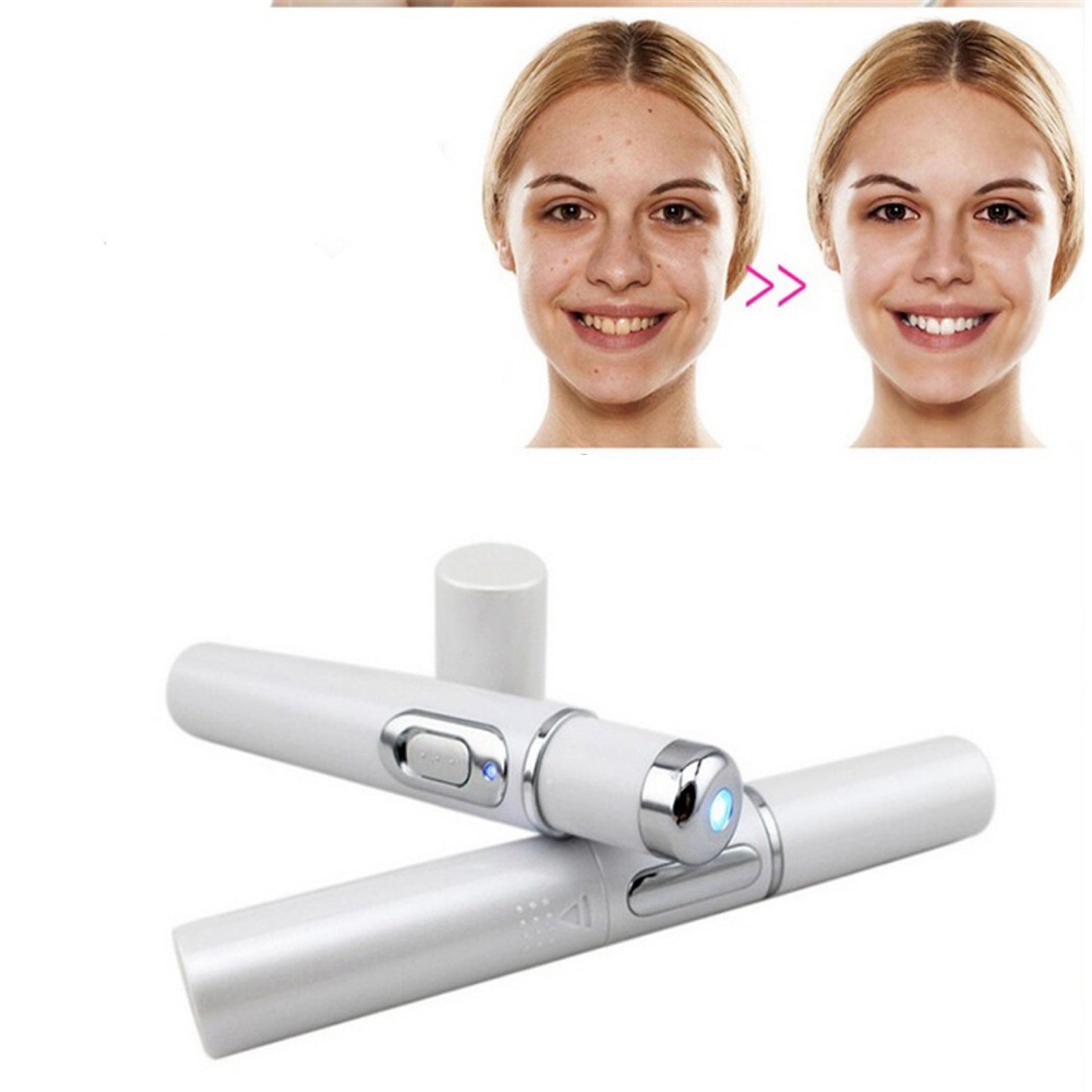 Wrinkle Blemish Pore Acne Scar Remover Pen - Zap Your Zits with the Pore Ninja Pen