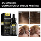 Yellow Hair Oil for Frizz Control and Repair 30ml Essential - yellow hair oil frizz control repair